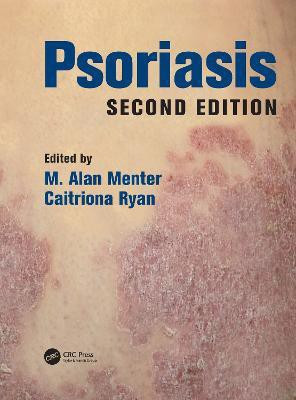 Psoriasis(English, Electronic book text, unknown)