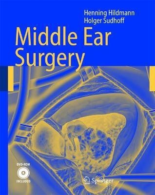 Middle Ear Surgery(English, Electronic book text, Hildmann Henning)