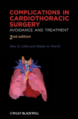 Complications in Cardiothoracic Surgery(English, Hardcover, unknown)