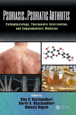 Psoriasis and Psoriatic Arthritis(English, Hardcover, unknown)