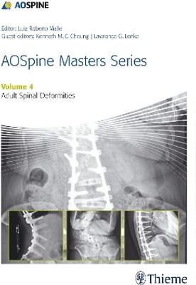 AOSpine Master Series, Vol. 4: Adult Spinal Deformities(English, Hardcover, unknown)