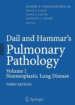 Dail and Hammar's Pulmonary Pathology(English, Hardcover, unknown)