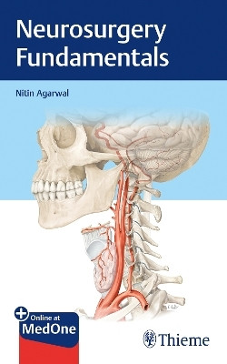 Neurosurgery Fundamentals(English, Mixed media product, Agarwal Nitin)