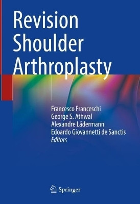 Revision Shoulder Arthroplasty(English, Hardcover, unknown)