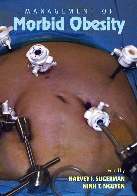 Management of Morbid Obesity(English, Hardcover, unknown)