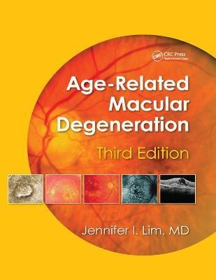 Age-Related Macular Degeneration(English, Paperback, unknown)