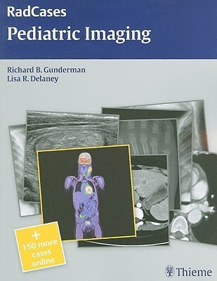 Radcases Pediatric Imaging 1 Pap/Psc Edition(English, Paperback, Gunderman Richard B.)