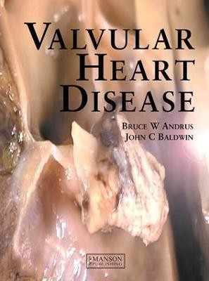 Valvular Heart Disease(English, Electronic book text, Andrus Bruce)