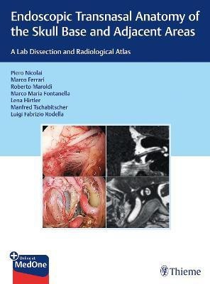 Endoscopic Transnasal Anatomy of the Skull Base and Adjacent Areas(English, Mixed media product, unknown)