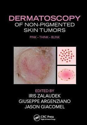 Dermatoscopy of Non-Pigmented Skin Tumors(English, Electronic book text, unknown)