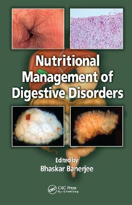 Nutritional Management of Digestive Disorders(English, Hardcover, unknown)