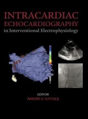 Intracardiac Echocardiography in Interventional Electrophysiology(English, Hardcover, unknown)