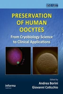 Preservation of Human Oocytes(English, Hardcover, unknown)