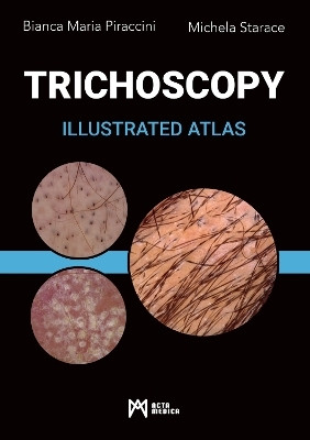 Trichoscopy(English, Hardcover, Piraccini Bianca Maria)