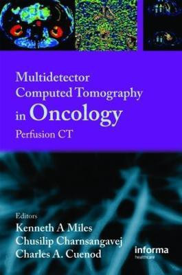 Multi-Detector Computed Tomography in Oncology(English, Hardcover, unknown)