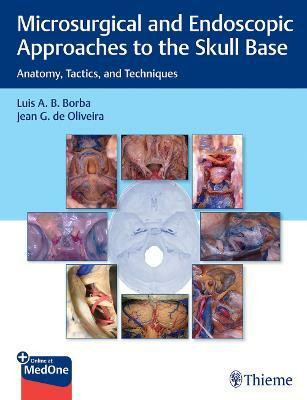 Microsurgical and Endoscopic Approaches to the Skull Base(English, Mixed media product, Borba Luis)