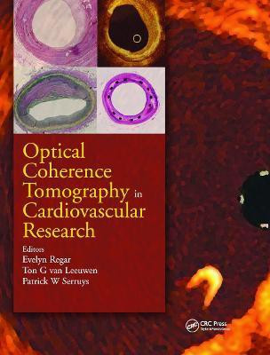 Optical Coherence Tomography in Cardiovascular Research(English, Hardcover, unknown)