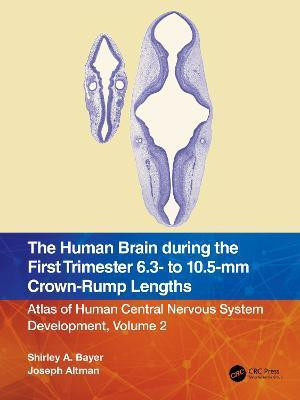 The Human Brain during the First Trimester 6.3- to 10.5-mm Crown-Rump Lengths(English, Paperback, Bayer Shirley A.)