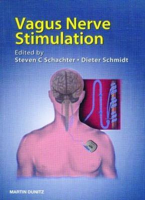 Vagus Nerve Stimulation(English, Paperback, unknown)