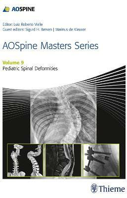 AOSpine Masters Series, Volume 9: Pediatric Spinal Deformities(English, Hardcover, unknown)