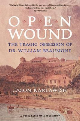 Open Wound(English, Paperback, Karlawish Jason)