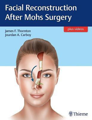 Facial Reconstruction After Mohs Surgery(English, Mixed media product, unknown)