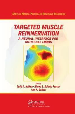 Targeted Muscle Reinnervation(English, Paperback, unknown)