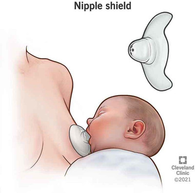 Breast shield for breastfeeding deals