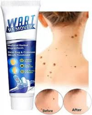 Luipui wart remover cream best for skin(1 Items in the set)