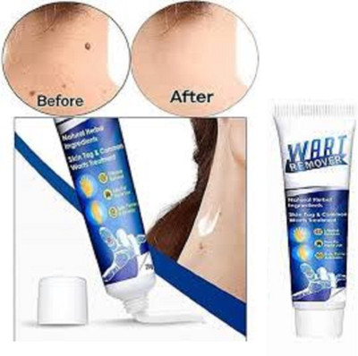 Luipui instant wart removal cream for all skin types(1 Items in the set)