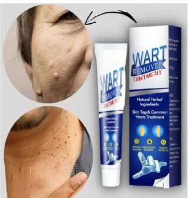 Luipui trending wart removal cream long lasting pack of 2(1 Items in the set)