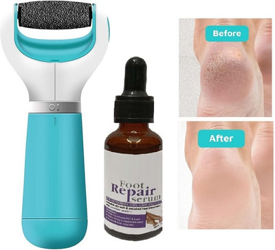 Latixmat Foot Serum With Rechargeable Electronic Skin Callus Remover Pedicure Foot File(2 Items in the set)