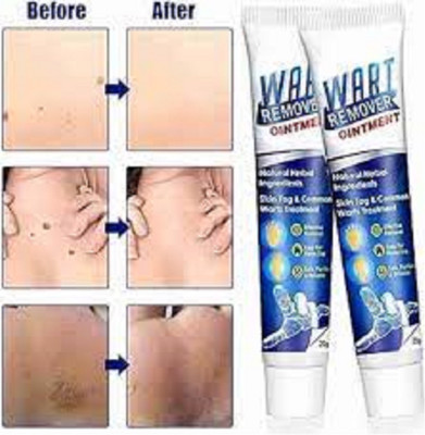 Luipui wart remover cream for moles pack of 2(1 Items in the set)