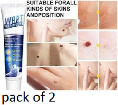 Luipui long lasting trending wart removal cream pack of 1(1 Items in the set)