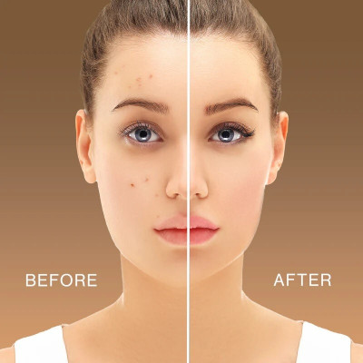 EVERERIN Liquid Light Weight Full Coverage with Matte finish  Concealer(MULTI COLOR, 50 g)