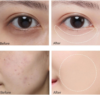 Latixmat Best Full Coverage  Concealer(Beige, 12 ml)