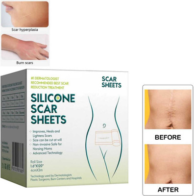 Silicon Scar Sheet Silicon Scar Removal Sheet For surgery injury burns cuts insect bites c-sections Crepe Bandage