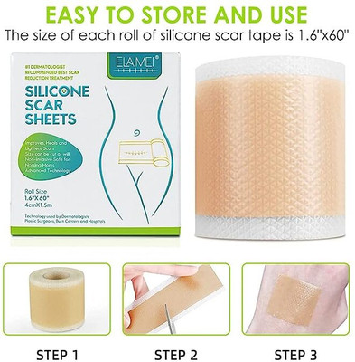 NEWSPARSH Riya Scar Sheets Flesh Color Silicone Scar Sheets For Dark Skin Crepe Bandage Crepe Bandage