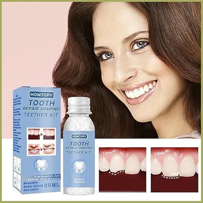 HOMTOPY Tooth Repair Kit, 30ml Moldable Beads for Temporary Teeth Fixes