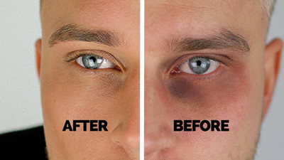 WOONGMI Under Eye Cream for Dark Circle for Women & Men(50 g)