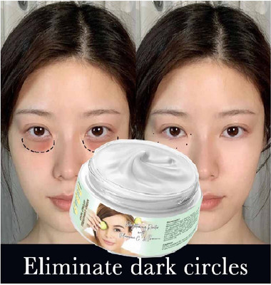 WOONGMI Best Under Eye Cream Lightens Dark Circles | Reduces Puffiness Cream For Womens(50 g)