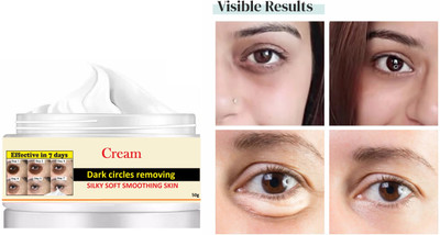 WOONGMI Eye Cream to Reduce Dark Circles, Puffiness and Fine Lines(50 g)