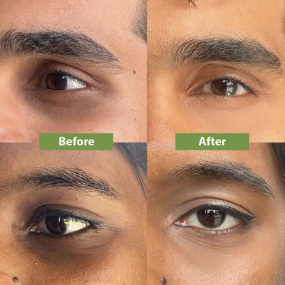manasona Under Eye Dark Circle Remover Cream(50 g)