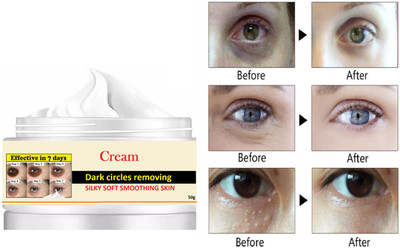 WOONGMI dark circle remover eye cream for puffiness(50 g)