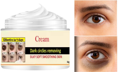 MYEONG Under Eye Creams Dark Circles Suits All Skin Types(50 g)