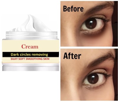 Latixmat Under Eye Cream for Dark Circles, Reduce Puffiness, Under Eye Wrinkle Cream(50 ml)