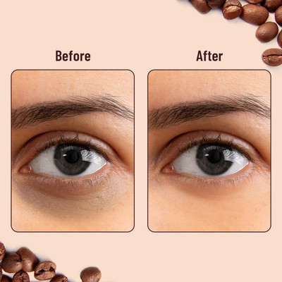 REIMICHI Under Eye Hydrogel Patches for Wrinkles & Puffy Eyes by Deep Hydration(100 ml)