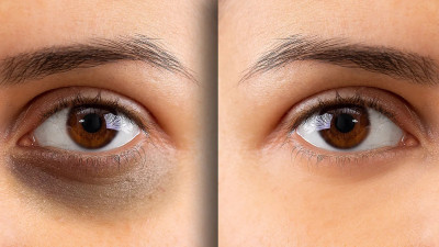Yuency Coffee Eye Patches For Puffiness Reduction & cooling(60 g)