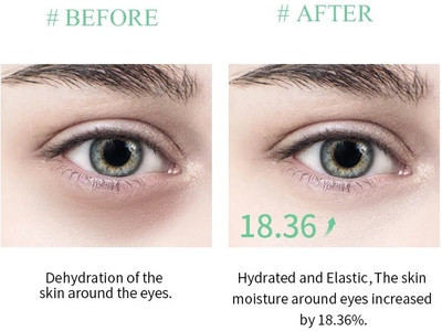 Emijun Hydrogel Under Eye Patches for Dark Circles & Puffiness(100 ml)