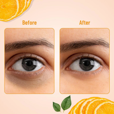 EVERERIN Under Eye Patches for Dark Circles and Puffy Eyes,(60Pcs 24K Gold) (60 ml)(60 g)